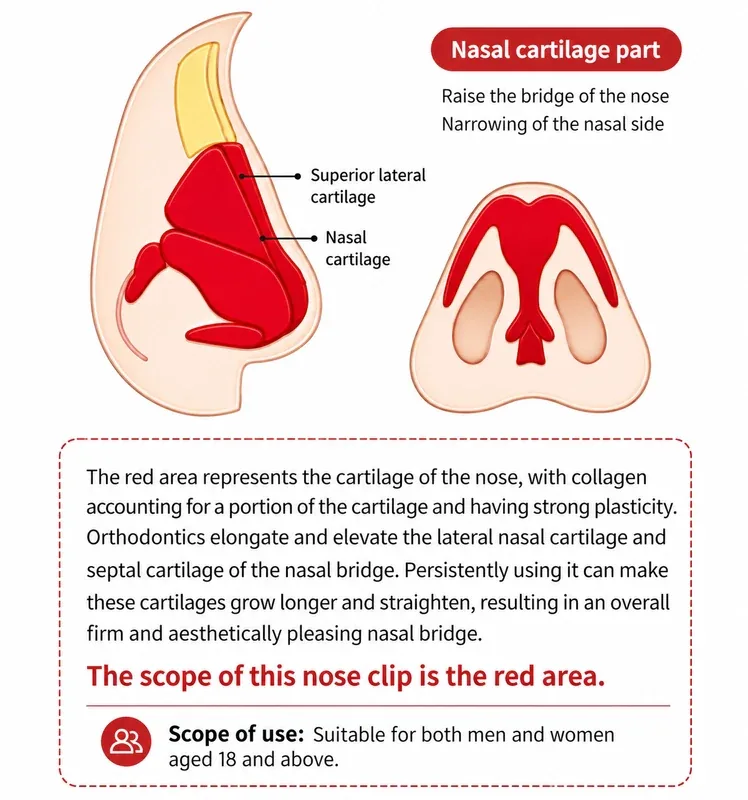 Diagram of the nasal bridge cartilage the Dentoora device works on
