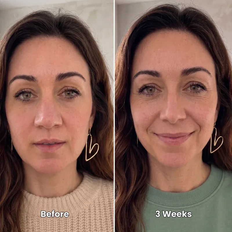 Ashley T. before and after 3 weeks of the Dentoora sculpting routine